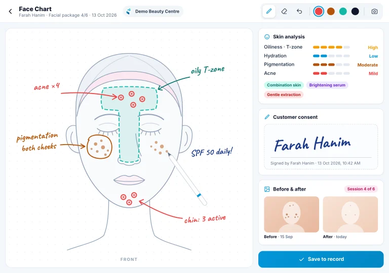 Face chart, photos & consent Facial treatment face chart on an iPad with the beautician's hand-drawn skin notes, before and after photos and the customer's e-signature