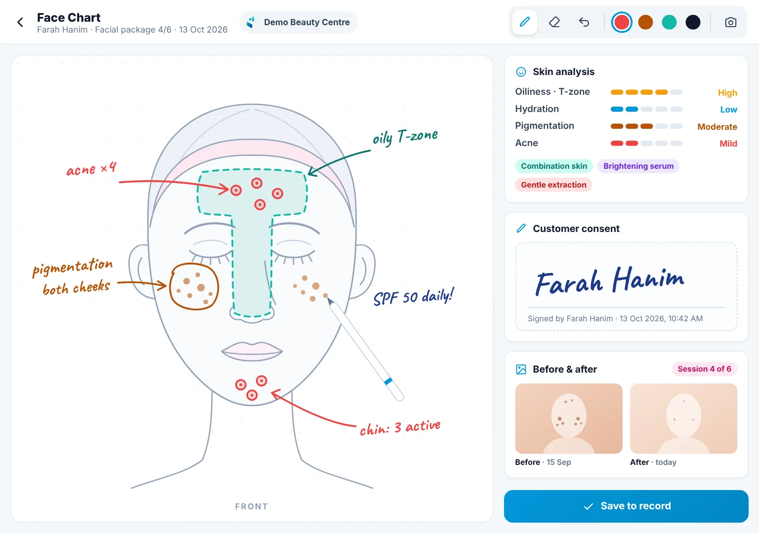 Facial treatment face chart on an iPad with the beautician's hand-drawn skin notes, before and after photos and the customer's e-signature