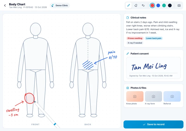Hand-drawn body chart iPad body chart with the doctor's hand-drawn notes and the patient's digital consent signature